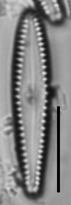 Gomphonema insularum LM6