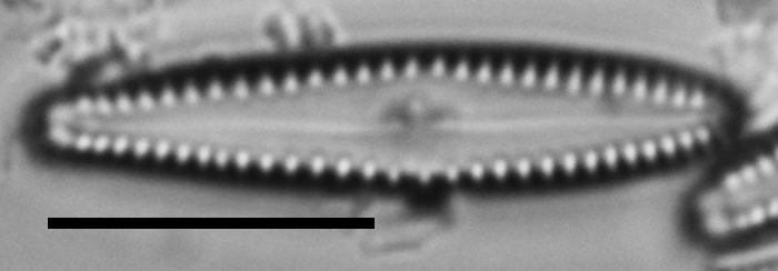 Gomphonema insularum LM6