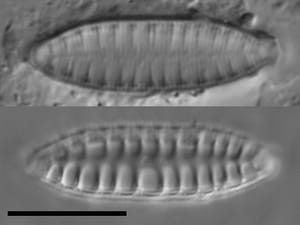 Surirella arctica LM7