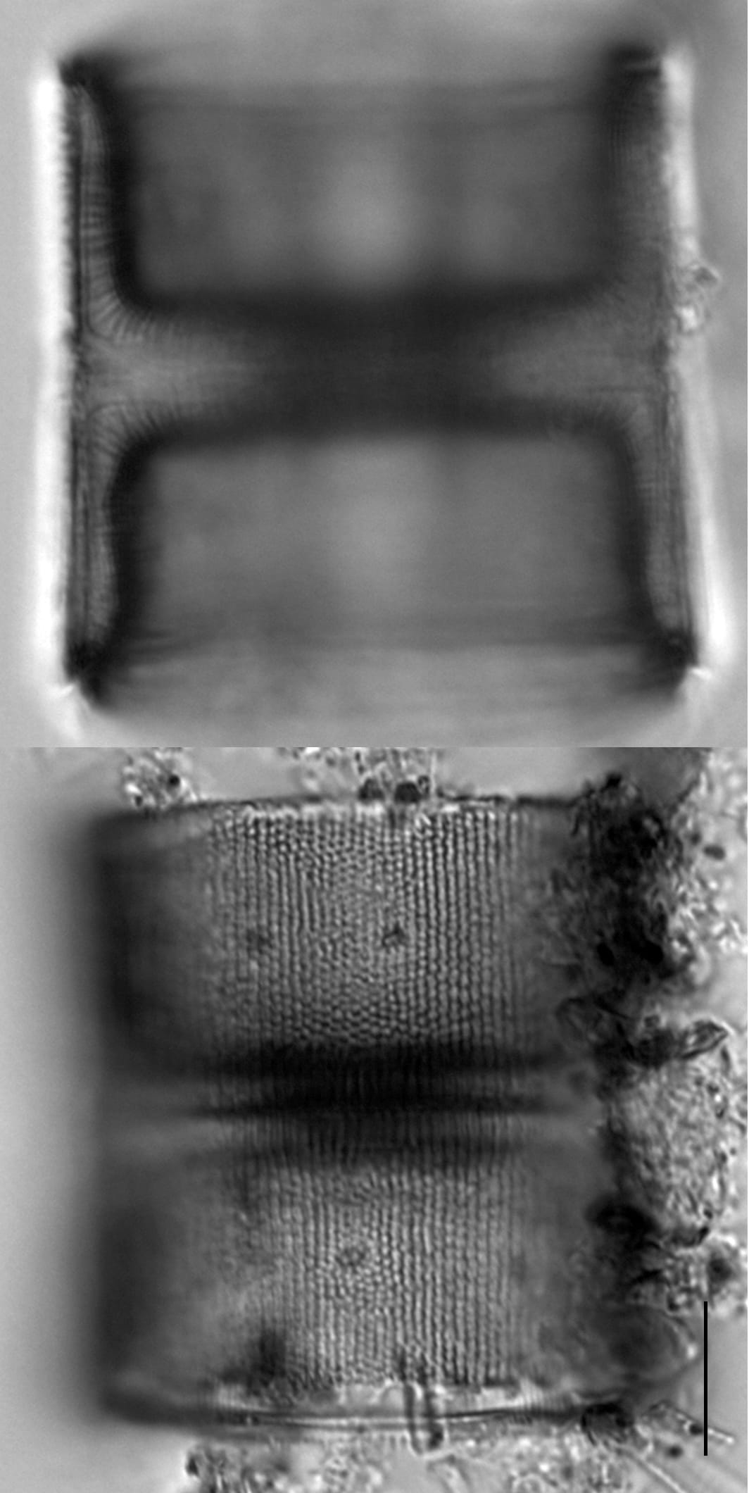 Melosira normanii LM6