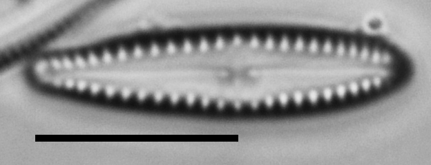 Gomphonema insularum LM7