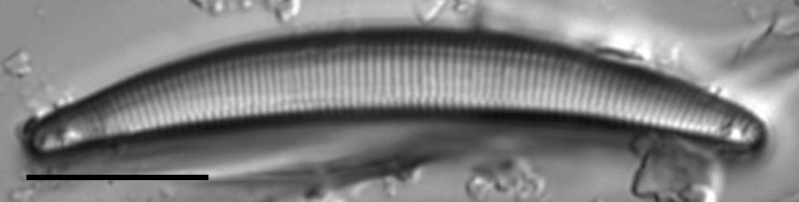 Eunotia sarraceniae LM5