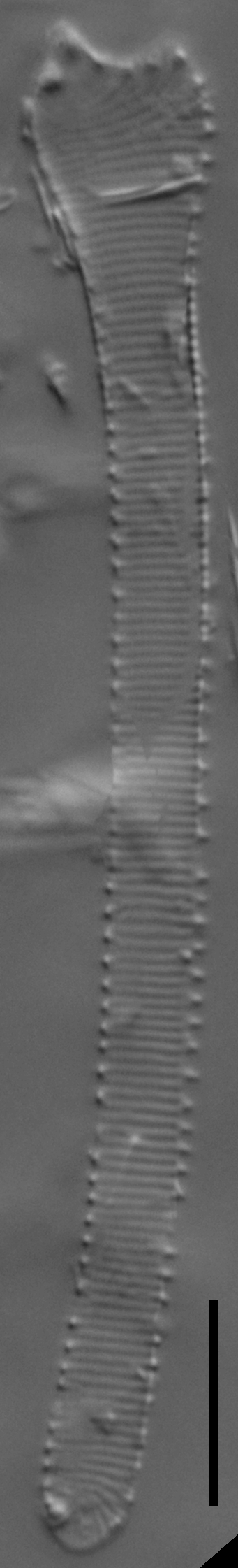 Actinella punctata LM2