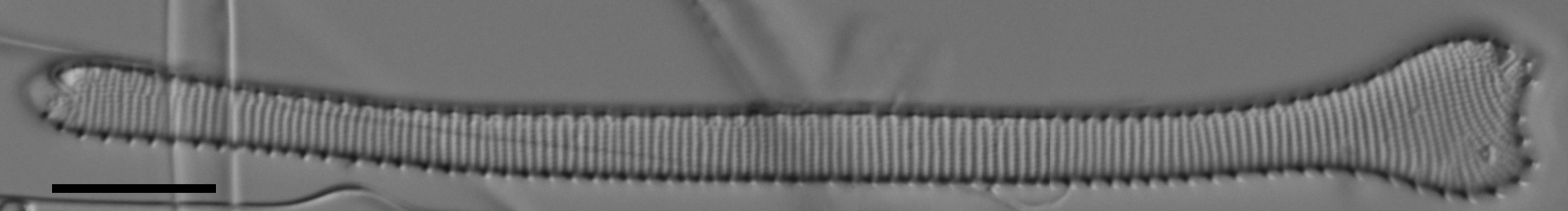 Actinella punctata LM6