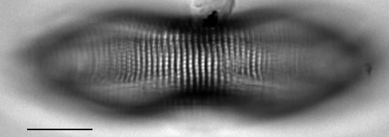 Amphora calumetica LM3