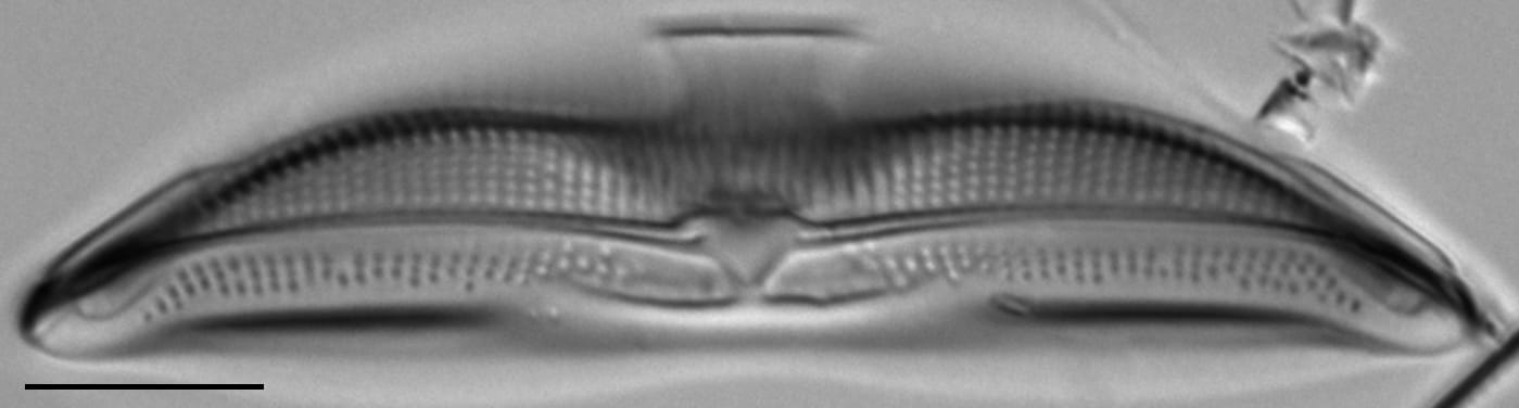 Amphora calumetica LM5