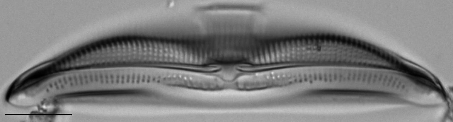 Amphora calumetica LM2