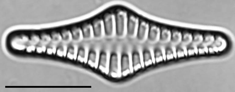 Staurosirella rhomboides LM1