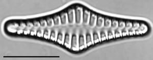 Staurosirella rhomboides LM1