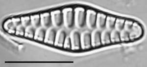 Staurosirella rhomboides LM2