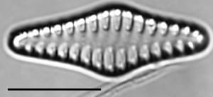 Staurosirella rhomboides LM3
