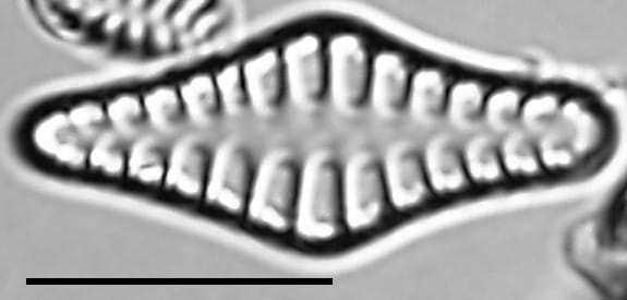 Staurosirella rhomboides LM4