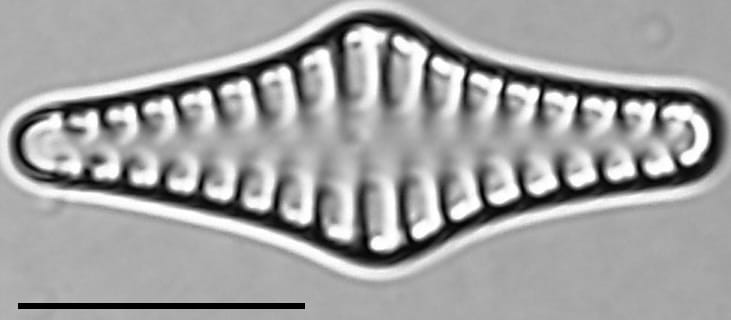 Staurosirella rhomboides LM5