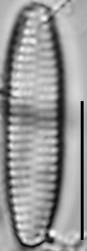 Pseudostaurosira americana LM1