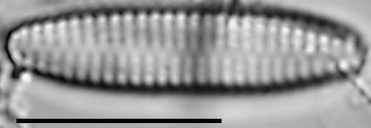 Pseudostaurosira americana LM1