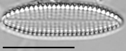 Pseudostaurosira americana LM6
