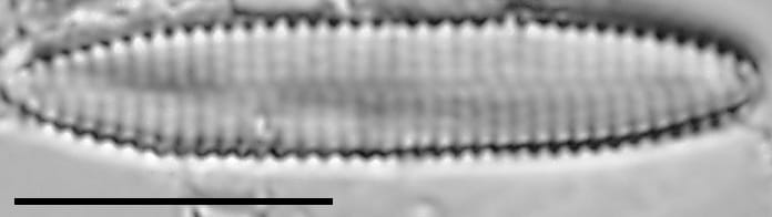 Pseudostaurosira americana LM2