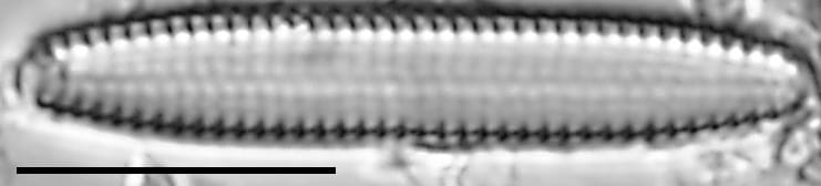 Pseudostaurosira americana LM3