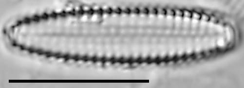 Pseudostaurosira americana LM4