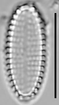 Pseudostaurosira americana LM5