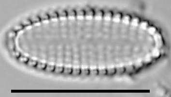 Pseudostaurosira americana LM5