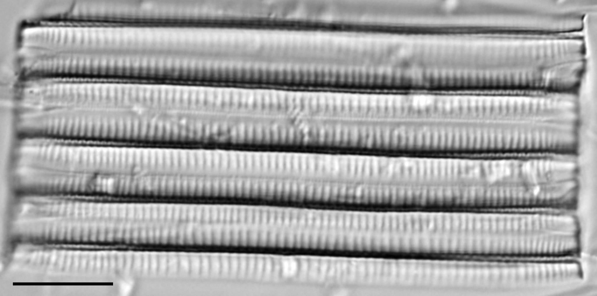 Ansp  Gc 54250  Fragilariforma Acidobiota  T5