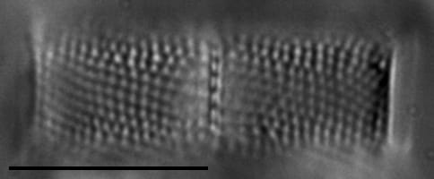 Aulacoseira ambigua LM2