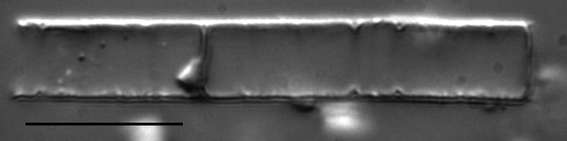 Aulacoseira ambigua LM3