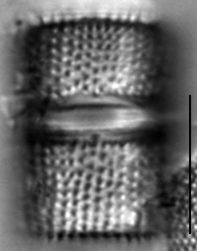 Aulacoseira islandica LM7