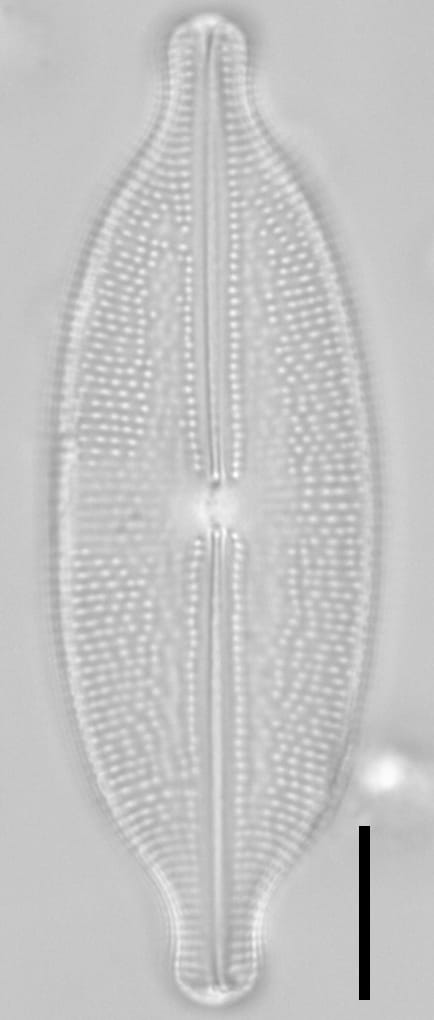 A Sphaerophora 4 Edited