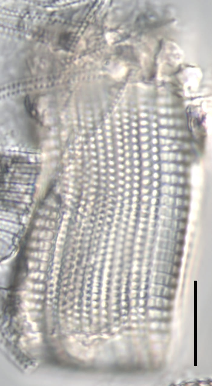 Achnanthes Brevipes LM1 Ill