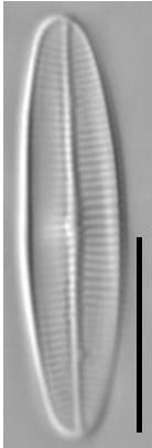 Achnanthidium crassum LM5