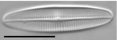 Achnanthidium crassum LM5
