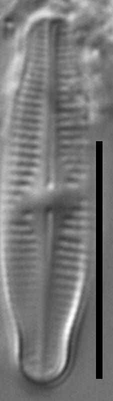 Achnanthidium thienimannii LM4