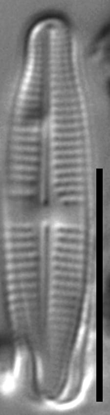 Achnanthidium thienimannii LM7