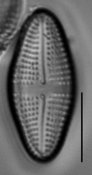Achnanthes longboardia LM5