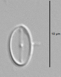 Amicula vermiculata LM1