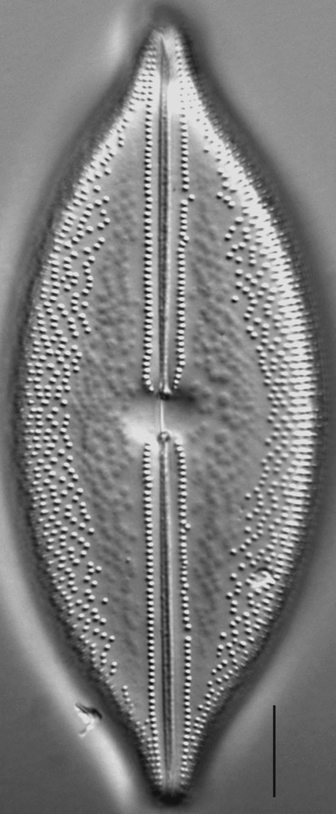 Anomoeoneis Sculpta LM6