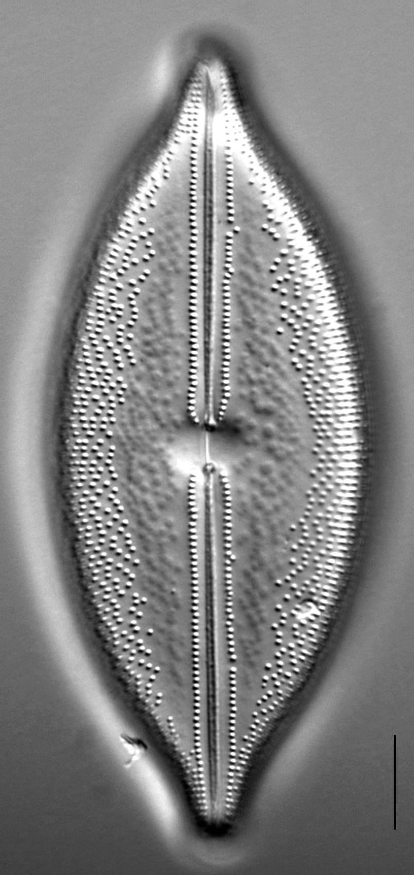 Anomoeoneis Sphaerophora F Sculpta Ill 2018 12 Image1