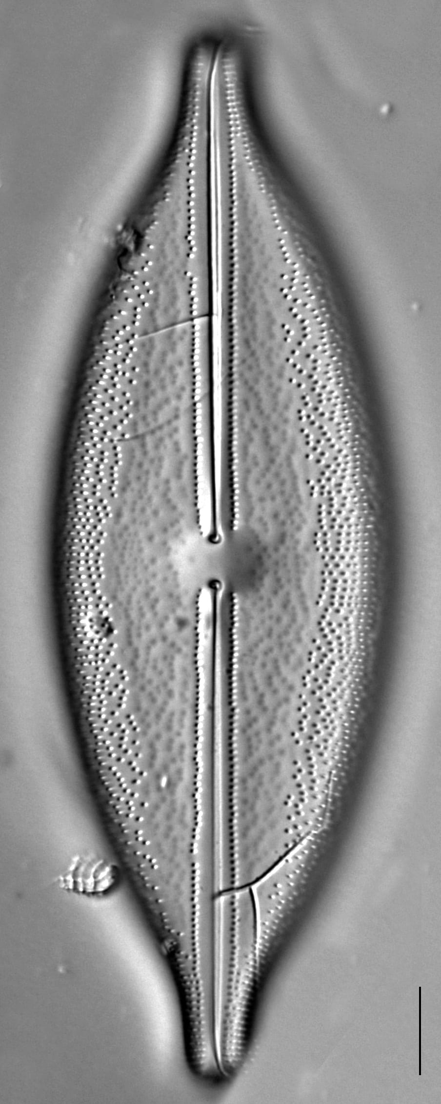 Anomoeoneis Sphaerophora F Sculpta Ill 2018 12 Image2