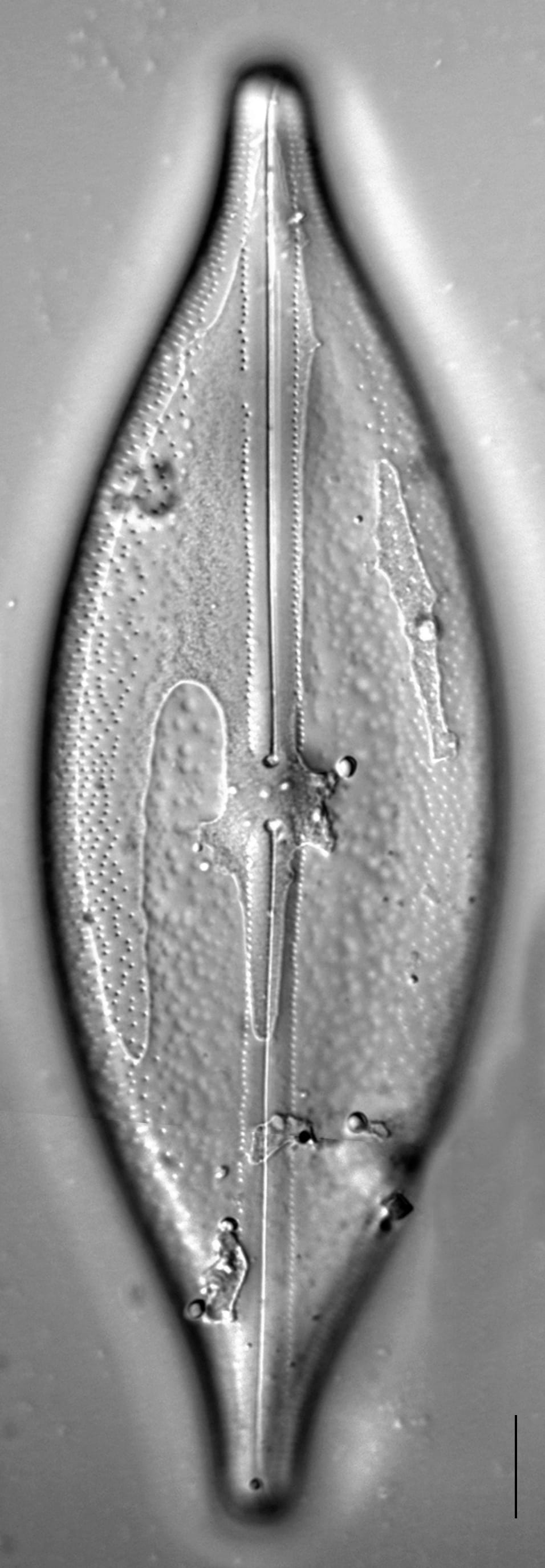 Anomoeoneis Sphaerophora F Sculpta Ill L 6 24 Image1