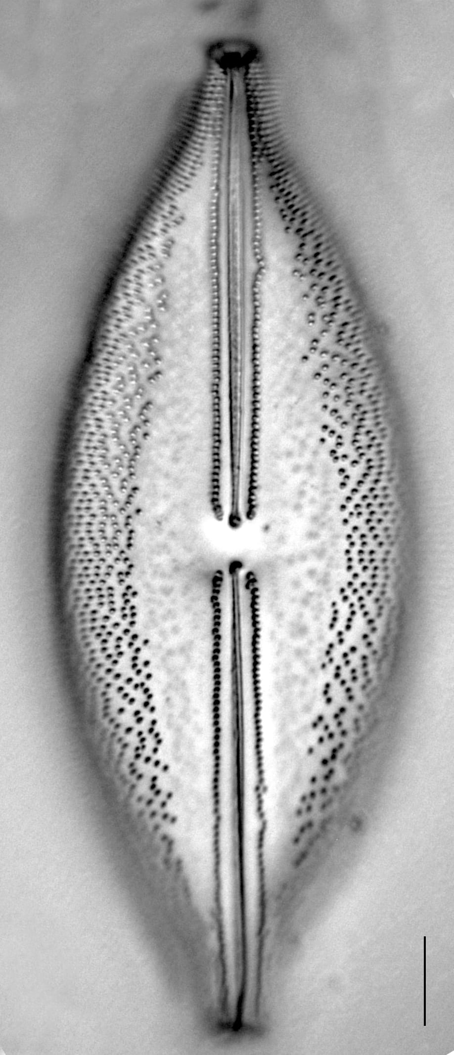 Anomoeoneis Sphaerophora F Sculpta Ill L 7 26 Image2