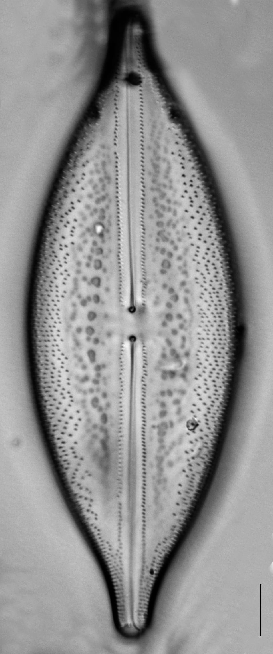 Anomoeoneis Sphaerophora F Sculpta Ill L 7 26 Image4