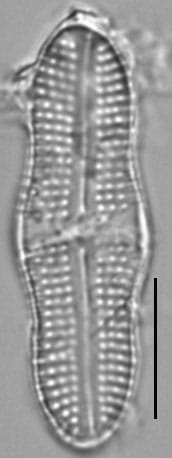 Achnanthes tumescens LM7