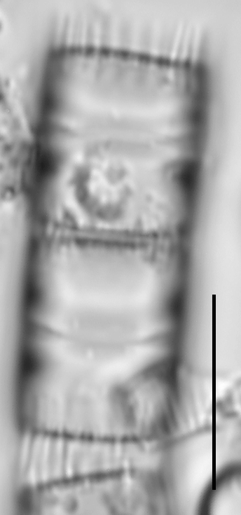 Aulacoseira pseudoamericana LM6