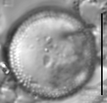 Aulacoseira pseudoamericana LM7