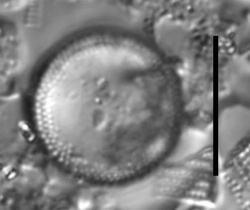 Aulacoseira pseudoamericana LM3