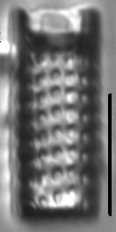 Aulacoseira canadensis LM3