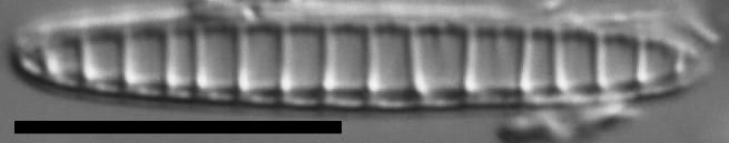 Denticula subtilis LM1