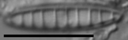 Denticula subtilis LM4